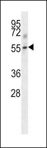 ANTI-MOUSE TGFBR1 (CENTER) antibody produced in rabbit