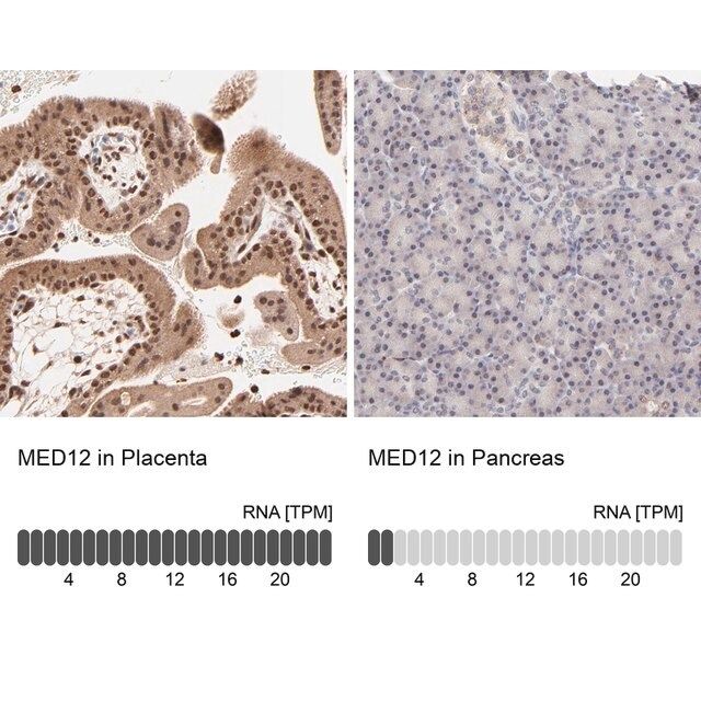 Anti-MED12 antibody produced in rabbit