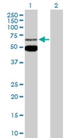 Anti-MEF2C antibody produced in rabbit