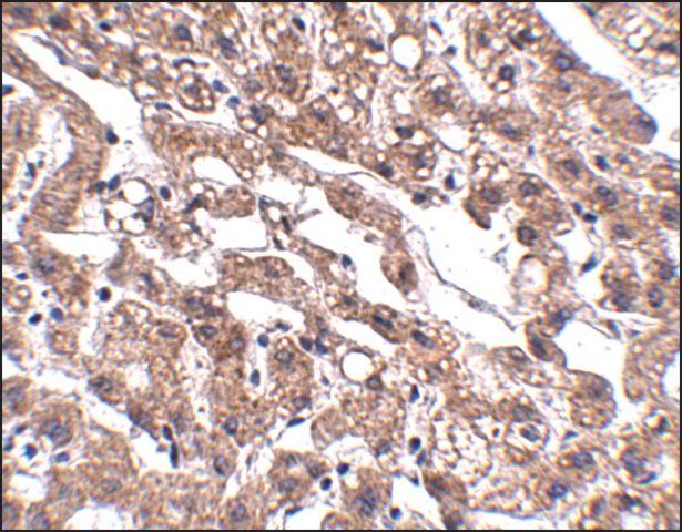 Anti-MACC1 antibody produced in rabbit