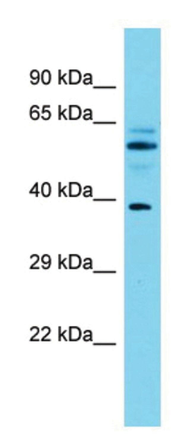 Anti-MACROD1 (N-terminal) antibody produced in rabbit