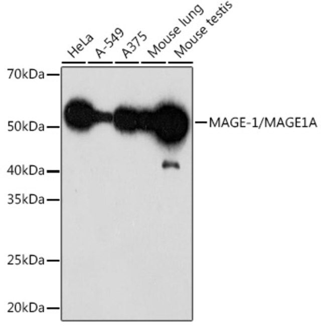 Anti-MAGE-1/MAGE1A antibody produced in rabbit