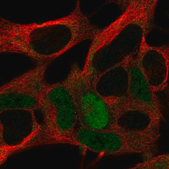 Anti-MAGEA10 antibody produced in rabbit