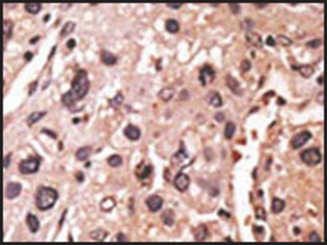 Anti-MAGEA12 (N-term) antibody produced in rabbit