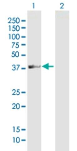 Anti-LOC113179 antibody produced in mouse