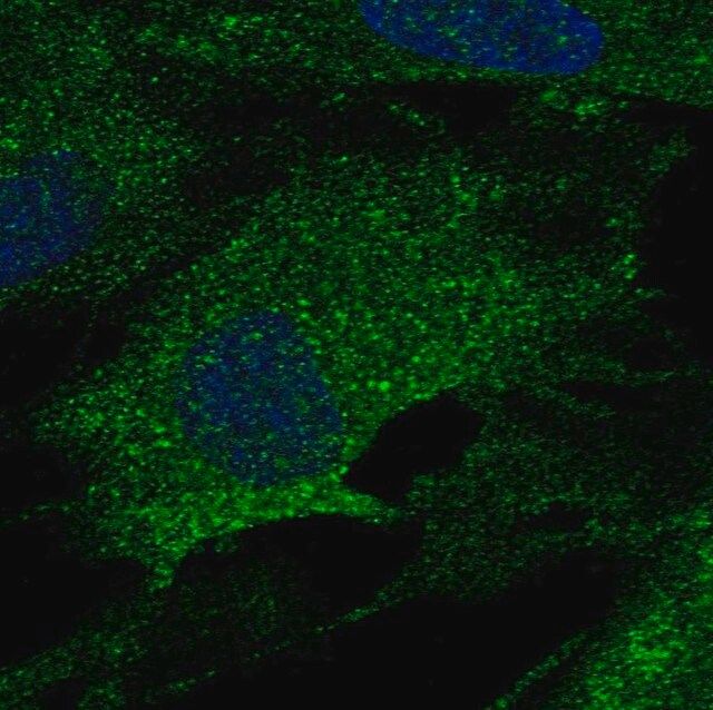 Anti-LOX antibody produced in rabbit