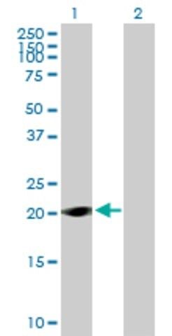 Anti-LOC285697 antibody produced in mouse