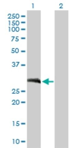 Anti-LOR antibody produced in mouse