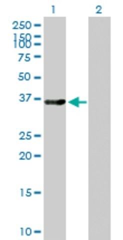 Anti-LMOD1 antibody produced in mouse