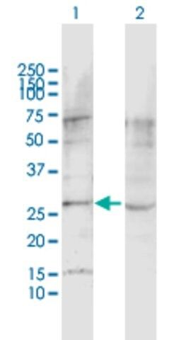 Anti-LPHN1 antibody produced in rabbit