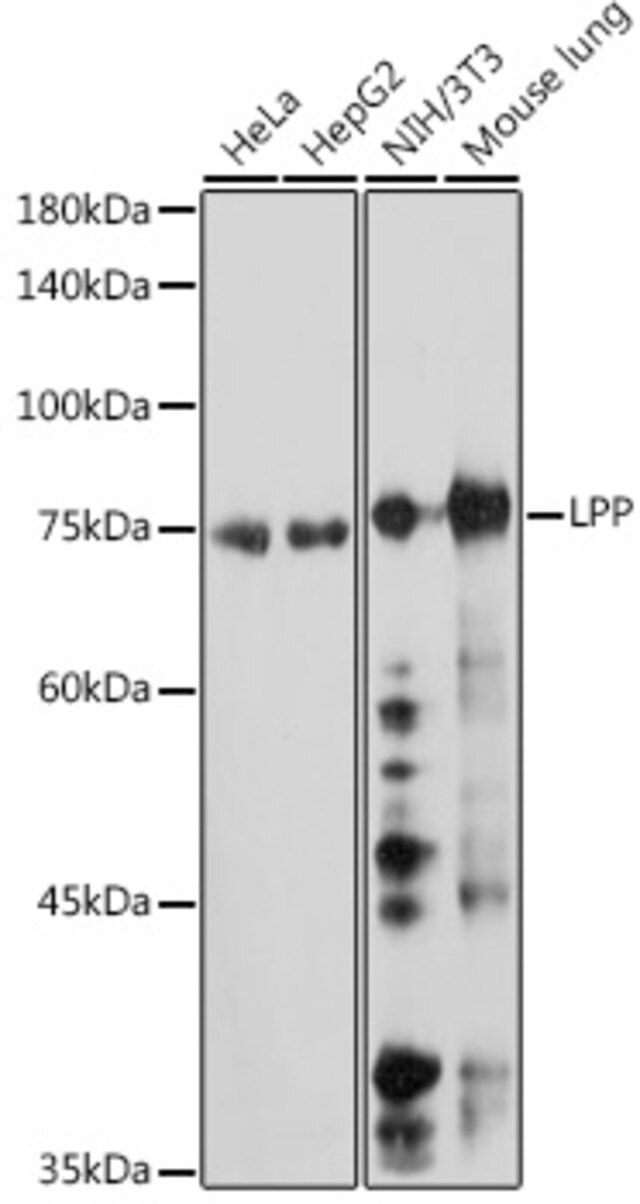 Anti-LPP antibody produced in rabbit