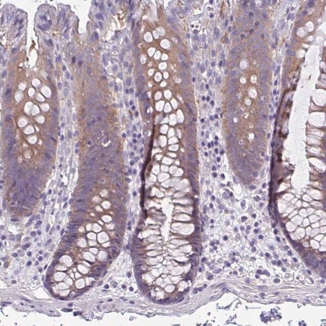 Anti-LPIN3 antibody produced in rabbit