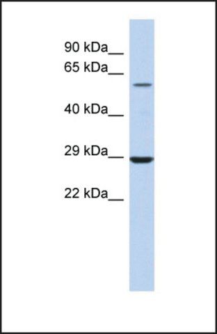 Anti-LPCAT1 antibody produced in rabbit