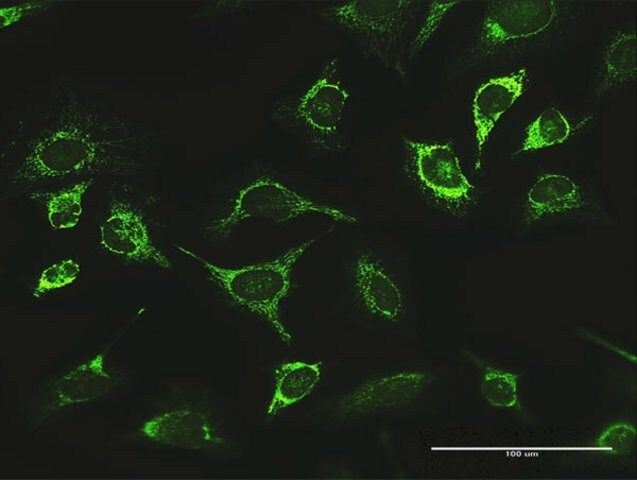 Anti-LONP1 antibody produced in rabbit