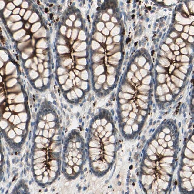 Anti-LMTK2 antibody produced in rabbit