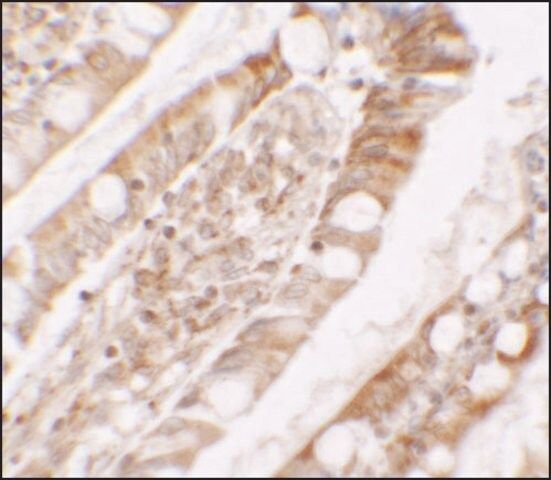 Anti-LPIN1 antibody produced in rabbit