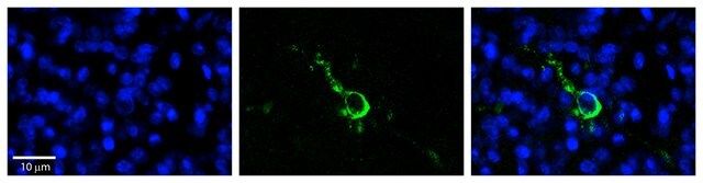 Anti-LPIN1 antibody produced in rabbit