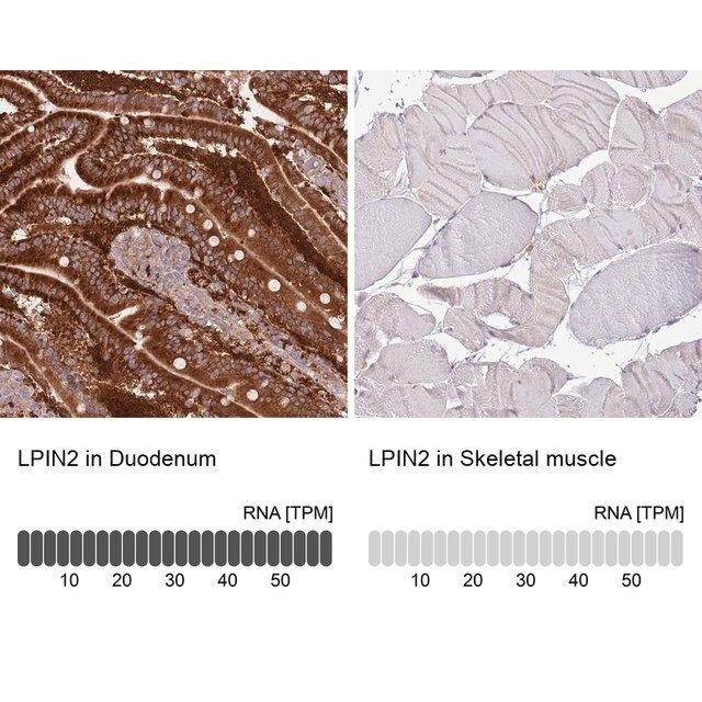 Anti-LPIN2 antibody produced in rabbit