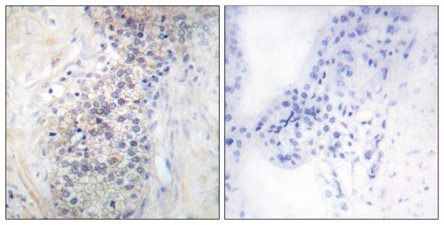 Anti-LRAT antibody produced in rabbit