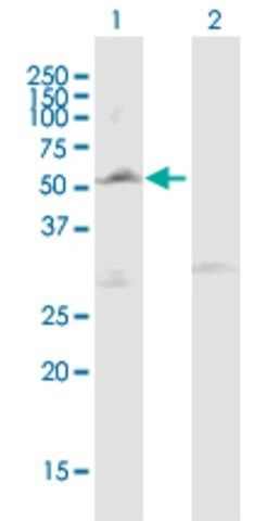 Anti-LPL antibody produced in mouse