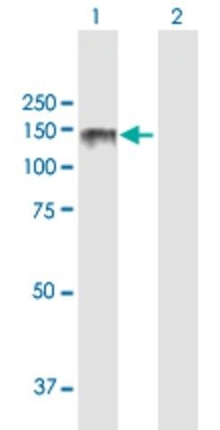 ANTI-LPIN2 antibody produced in mouse