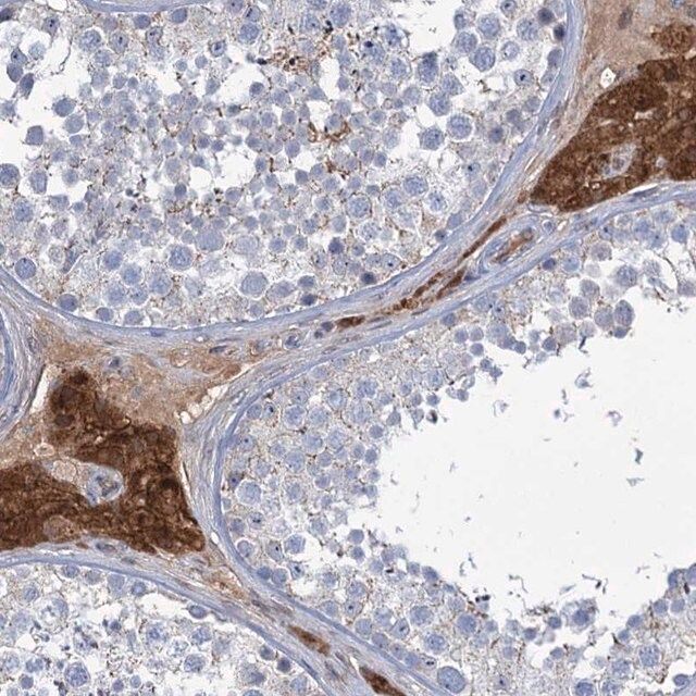 Anti-LPIN1 antibody produced in rabbit