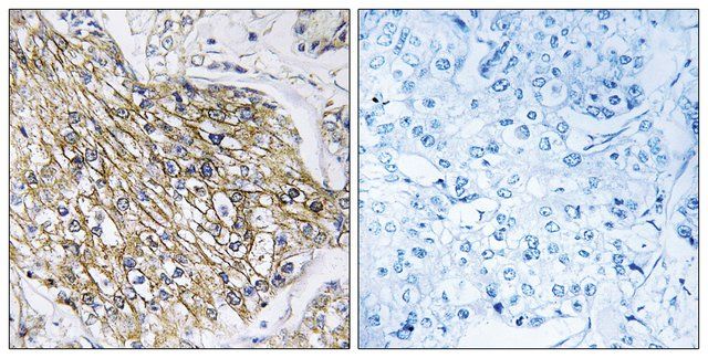 Anti-LPHN2 antibody produced in rabbit