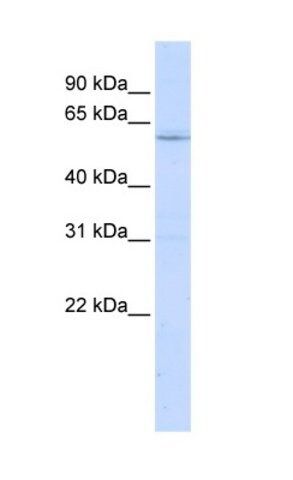 Anti-LRRC15 antibody produced in rabbit