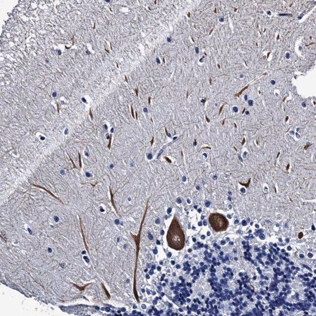 Anti-LRRC30 antibody produced in rabbit