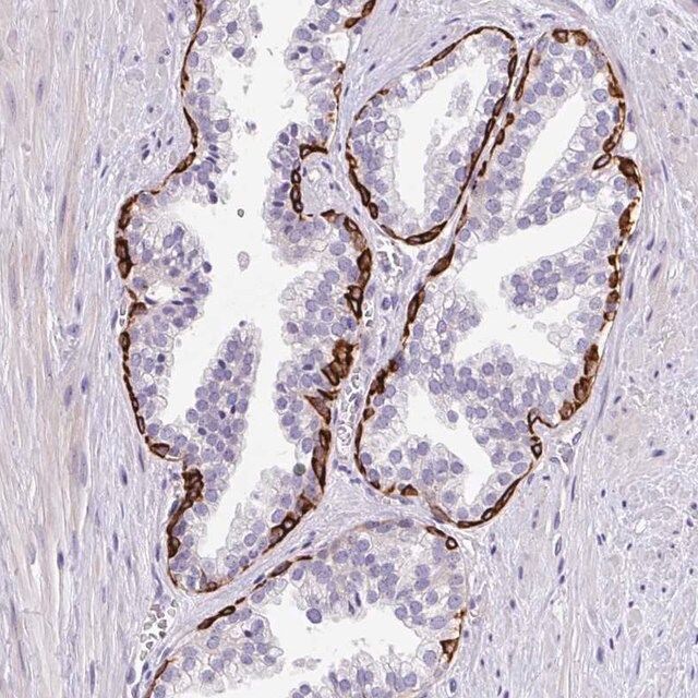 Anti-LRRC26 antibody produced in rabbit