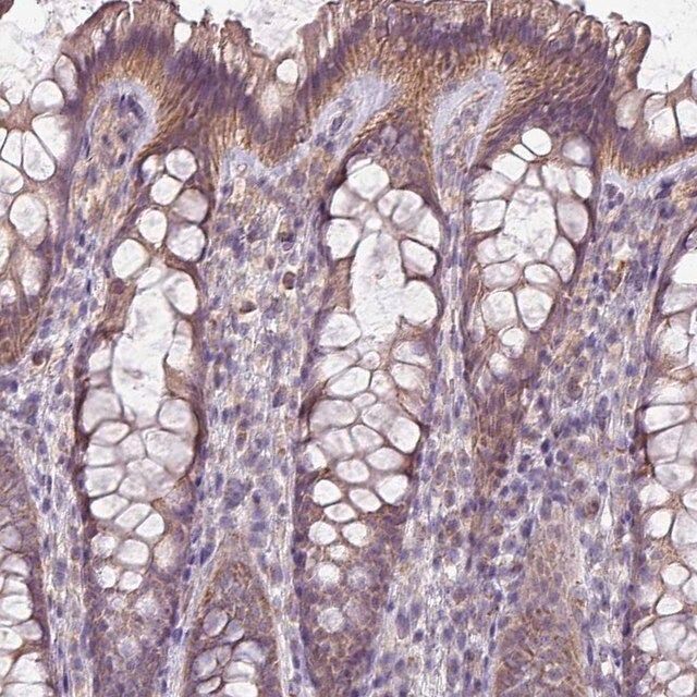 Anti-LRRC9 antibody produced in rabbit