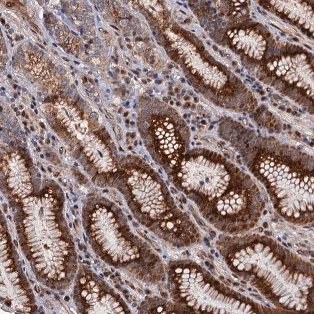 Anti-LRRC63 antibody produced in rabbit