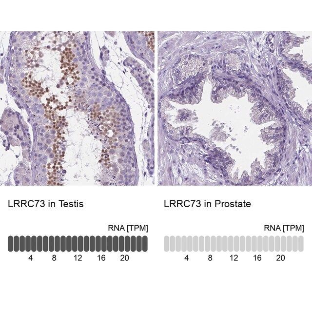 Anti-LRRC73 antibody produced in rabbit