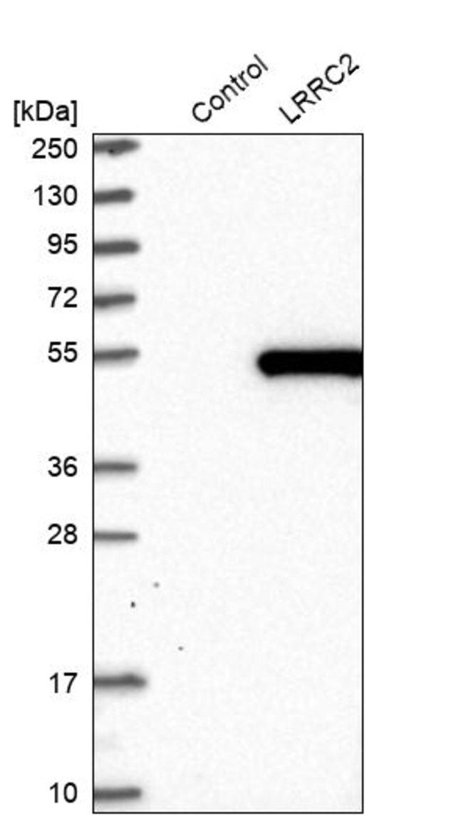 Anti-LRRC2 antibody produced in rabbit