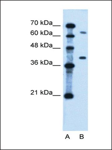 Anti-LRRC26 antibody produced in rabbit