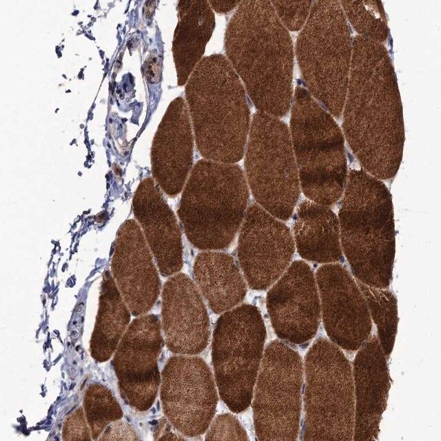 Anti-LRRC63 antibody produced in rabbit