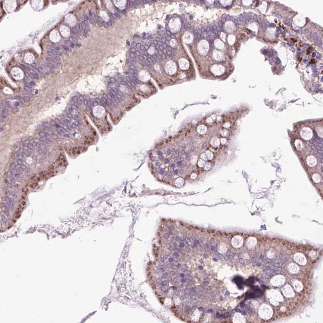 Anti-LZTR1 antibody produced in rabbit