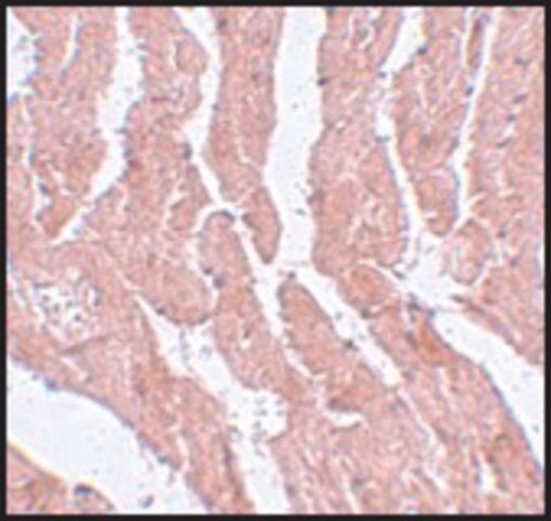 Anti-LZTR1 antibody produced in rabbit