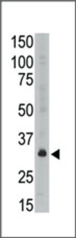 Anti-MAGEA6 (C-term) antibody produced in rabbit