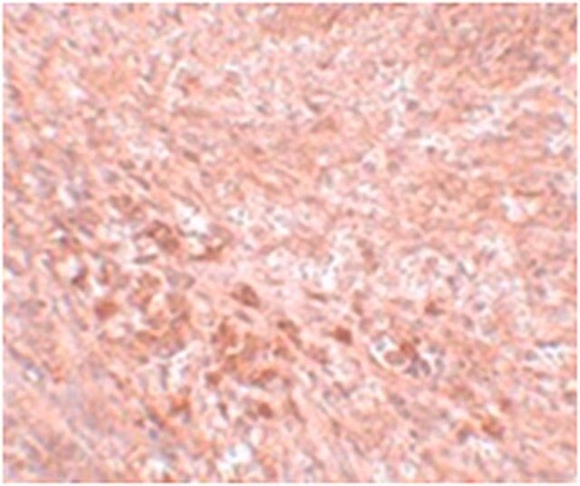 Anti-LZTR2 Antibody