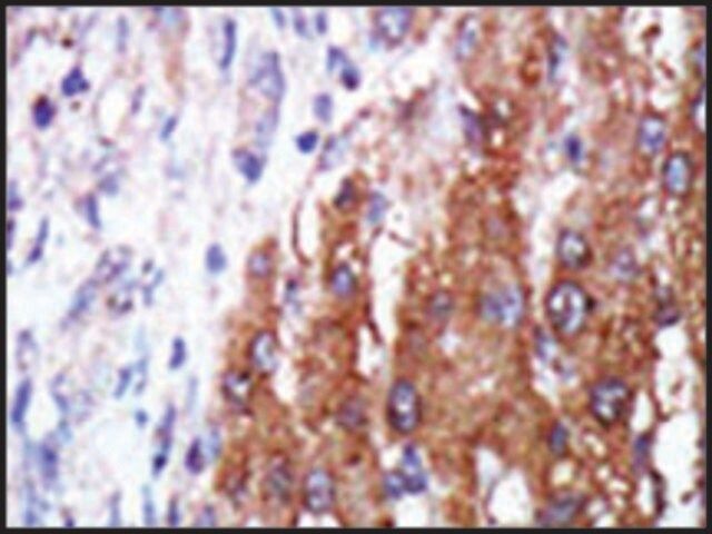 Anti-LZK (C-term) antibody produced in rabbit