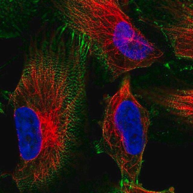 Anti-MACF1 antibody produced in rabbit