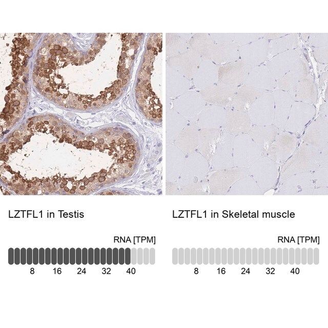 Anti-LZTFL1 antibody produced in rabbit