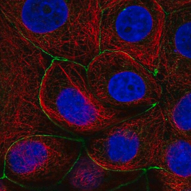 Anti-LNX1 antibody produced in rabbit