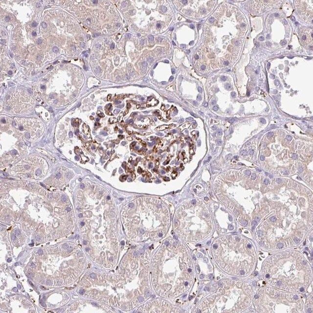 Anti-LMO7DN antibody produced in rabbit