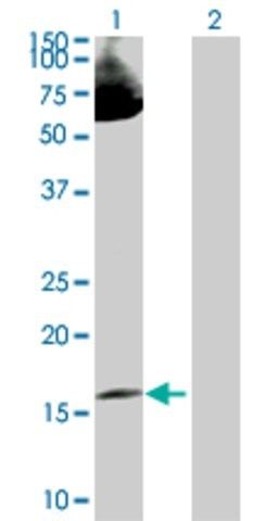 Anti-LMO2 antibody produced in rabbit