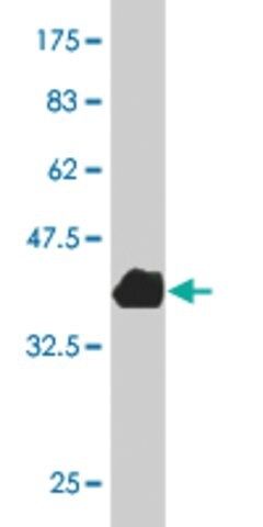 ANTI-LMTK3 antibody produced in mouse