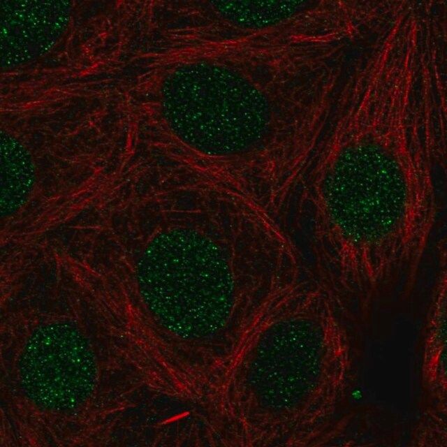 Anti-LMX1B antibody produced in rabbit