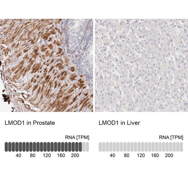 Anti-LMOD1 antibody produced in rabbit