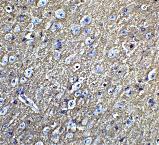 Anti-LMX1B antibody produced in rabbit